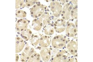 Immunohistochemistry of paraffin-embedded Human gastric using POU2F1 antibody at dilution of 1:100 (x400 lens). (POU2F1 抗体)