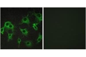 Immunofluorescence analysis of COS7 cells, using ADRB2 Antibody. (beta 2 Adrenergic Receptor 抗体  (AA 336-385))