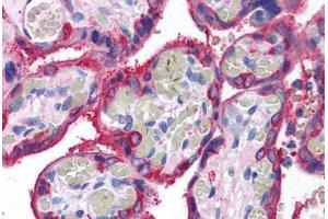 Human Placenta (formalin-fixed, paraffin-embedded) stained with TGM2 antibody ABIN307194 at 5 ug/ml followed by biotinylated goat anti-rabbit IgG secondary antibody ABIN481713, alkaline phosphatase-streptavidin and chromogen. (Transglutaminase 2 抗体)