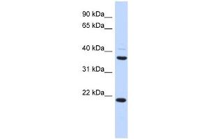 TMEM74 antibody used at 1 ug/ml to detect target protein. (TMEM74 抗体  (Middle Region))