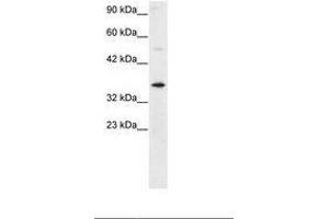 Image no. 2 for anti-General Transcription Factor IIH, Polypeptide 3, 34kD (GTF2H3) (AA 59-108) antibody (ABIN6735772) (GTF2H3 抗体  (AA 59-108))