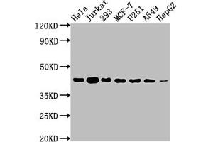 Western Blot Positive WB detected in: Hela whole cell lysate, Jurkat whole cell lysate, 293 whole cell lysate, MCF-7 whole cell lysate, U251 whole cell lysate, A549 whole cell lysate, HepG2 whole cell lysate All lanes: AURKB antibody at 1:2000 Secondary Goat polyclonal to rabbit IgG at 1/50000 dilution Predicted band size: 40, 36, 17, 35 kDa Observed band size: 40 kDa (Recombinant Aurora Kinase B 抗体)