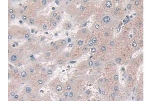 Immunohistochemistry (IHC) image for anti-N-Acylsphingosine Amidohydrolase (Acid Ceramidase) 1 (ASAH1) (AA 144-395) antibody (ABIN7434806)