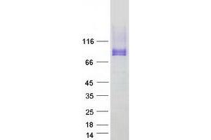 Western Blotting (WB) image for Podocalyxin-Like (PODXL) (Transcript Variant 2) protein (Myc-DYKDDDDK Tag) (ABIN2729274)