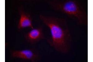 Immunofluorescence staining of methanol-fixed Hela cells using syk(phospho-Tyr323) Antibody. (SYK 抗体  (pTyr323))