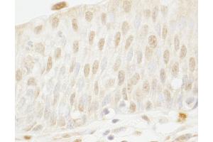 Immunohistochemistry (IHC) image for anti-Myb-Binding Protein 1A (MYBBP1A) (AA 450-500) antibody (ABIN7448678) (MYBBP1A 抗体  (AA 450-500))