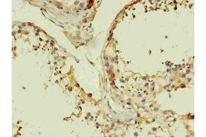 Immunohistochemistry of paraffin-embedded human testis using ABIN7140933 in 30 μg/mL dilute concentrations. (CD14 抗体)