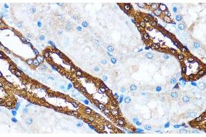 Immunohistochemistry of paraffin-embedded Rat kidney using PIK3CA Polyclonal Antibody at dilution of 1:100 (40x lens). (PIK3CA 抗体)