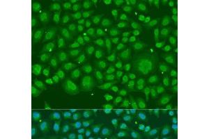Immunofluorescence analysis of U2OS cells using HNRNPR Polyclonal Antibody at dilution of 1:100. (HNRNPR 抗体)