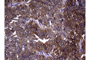 Image no. 3 for anti-Ribonucleotide Reductase M1 (RRM1) (AA 541-792) antibody (ABIN1491583)