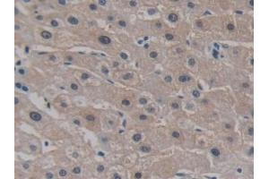 Detection of CELSR3 in Human Liver Tissue using Polyclonal Antibody to Cadherin EGF LAG Seven Pass G-Type Receptor 3 (CELSR3)