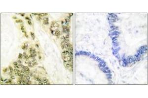 Immunohistochemistry (IHC) image for anti-Thyroid Hormone Receptor, alpha (THRA) (AA 10-59) antibody (ABIN2889264) (THRA 抗体  (AA 10-59))