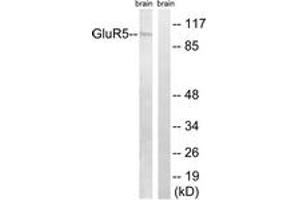 Western blot analysis of extracts from mouse brain cells, using GluR5 Antibody. (GRIK1 抗体  (AA 10-59))
