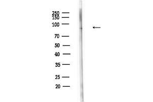 anti-Lipase, Hormone-Sensitive (LIPE) (pSer554), (pSer855) antibody