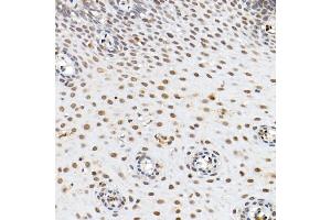 Immunohistochemistry (IHC) image for anti-Actin, alpha 2, Smooth Muscle, Aorta (ACTA2) (AA 1-124) antibody (ABIN6136473)