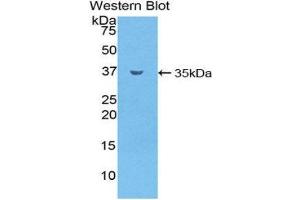 Western Blotting (WB) image for anti-Sphingomyelin phosphodiesterase 1, Acid Lysosomal (SMPD1) (AA 319-579) antibody (ABIN1858086) (SMPD1 抗体  (AA 319-579))