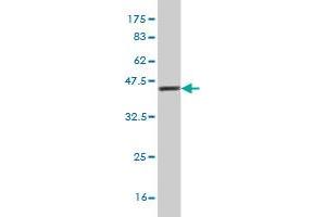 Western Blotting (WB) image for anti-Protein Interacting With Protein Kinase C, alpha 1 (PICK1) (AA 266-375) antibody (ABIN522929)