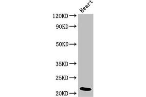 Western Blot Positive WB detected in: Rat heart tissue All lanes: NDUFB9 antibody at 4 μg/mL Secondary Goat polyclonal to rabbit IgG at 1/50000 dilution Predicted band size: 22 kDa Observed band size: 22 kDa (NDUFB9 抗体  (AA 50-179))