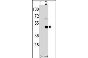 Western blot analysis of GEA9 (arrow) using rabbit polyclonal GEA9 Antibody  (ABIN390111 and ABIN2840622). (MAGEA9 抗体  (AA 171-198))
