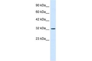 Western Blotting (WB) image for anti-SWI/SNF Related, Matrix Associated, Actin Dependent Regulator of Chromatin, Subfamily A, Member 2 (SMARCA2) antibody (ABIN2460965) (SMARCA2 抗体)