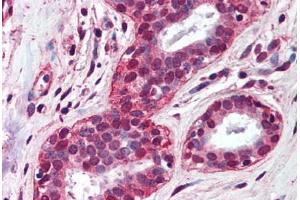 Human Breast (formalin-fixed, paraffin-embedded) stained with TLR4 antibody ABIN298531 at 5 ug/ml followed by biotinylated anti-mouse IgG secondary antibody ABIN481714, alkaline phosphatase-streptavidin and chromogen. (TLR4 抗体  (AA 100-200))