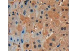 Used in DAB staining on fromalin fixed paraffin-embedded liver tissue (CCL9 抗体  (AA 22-122))