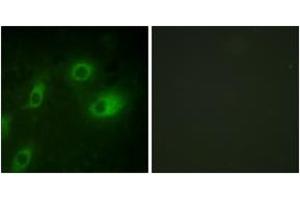 Immunofluorescence analysis of HeLa cells, using Keratin 18 (Phospho-Ser52) Antibody. (Cytokeratin 18 抗体  (pSer52))
