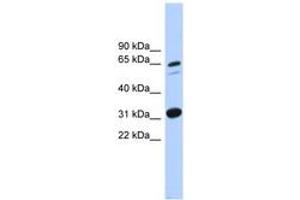 Image no. 1 for anti-Integrin alpha FG-GAP Repeat Containing 3 (ITFG3) (AA 431-480) antibody (ABIN6744874) (ITFG3 抗体  (AA 431-480))
