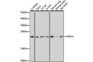 Western blot analysis of extracts of various cell lines, using RAB2A antibody. (RAB2A 抗体  (AA 1-212))
