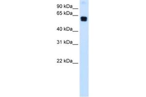 Western Blotting (WB) image for anti-Docking Protein 1, 62kDa (Downstream of tyrosine Kinase 1) (DOK1) antibody (ABIN2463701) (DOK1 抗体)
