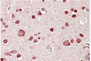 AP23695PU-N STK39 / SPAK Antibody staining of paraffin embedded Human Cerebral Cortex at 3. (STK39 抗体  (Internal Region))