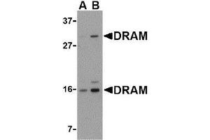 Western blot analysis of DRAM in 293 cell lysate with AP30304PU-N DRAM antibody at (A) 0. (DRAM 抗体  (C-Term))