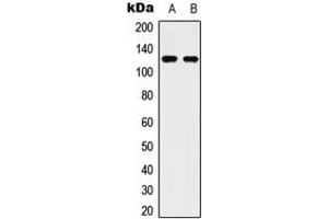 Western blot analysis of ULK2 expression in Hela (A), HepG2 (B) whole cell lysates. (ULK2 抗体  (C-Term))