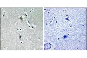 Immunohistochemistry analysis of paraffin-embedded human brain, using PKC thet (Phospho-Thr538) Antibody. (PKC theta 抗体  (pThr538))