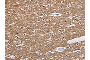 The image on the left is immunohistochemistry of paraffin-embedded Human brain tissue using ABIN7191592(NCR2 Antibody) at dilution 1/60, on the right is treated with synthetic peptide. (NKp44/NCR2 抗体)