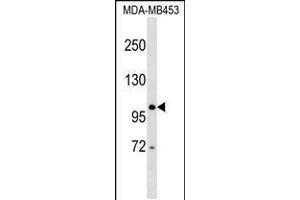 Western blot analysis in MDA-MB453 cell line lysates (35ug/lane). (DDX24 抗体  (AA 506-534))