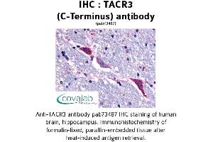 Image no. 1 for anti-Tachykinin Receptor 3 (TACR3) (C-Term), (Cytoplasmic Domain) antibody (ABIN1739880) (TACR3 抗体  (C-Term, Cytoplasmic Domain))
