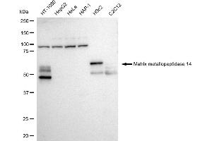 Western blotting analysis using Matrix metallopeptidase 14 antibody (ABIN7799340). (Recombinant MMP14 抗体)