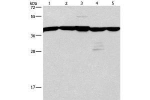 Western Blot analysis of A172 and 293T cell, Mouse kidney tissue, Human testis and brain malignant glioma tissue using GNA13 Polyclonal Antibody at dilution of 1:600 (GNA13 抗体)