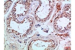 Immunohistochemical analysis of paraffin-embedded Human-testis, antibody was diluted at 1:100. (PIK3R2 抗体  (AA 1-60))