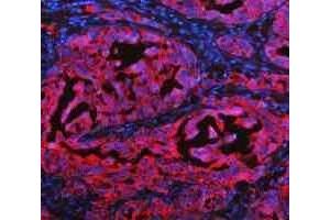 IF analysis of Cytokeratin 20/Krt20 using anti-Cytokeratin 20/Krt20 antibody (ABIN7601133). (KRT20 抗体  (AA 29-431))