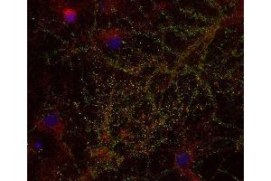 Indirect immunostaining of PFA fixed rat hippocampus neurons with anti-DAP 4 (dilution 1 : 500; green) and mouse anti-synapsin 1 (cat. (PRKRIR 抗体)