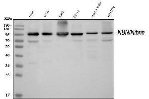 Western blot analysis of p95 NBS1 using anti-p95 NBS1 antibody (ABIN3043282). (Nibrin 抗体  (C-Term))