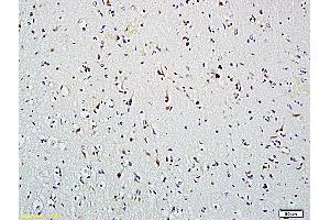 Formalin-fixed and paraffin embedded human brain labeled with Anti-HDAC2, Unconjugated (ABIN734813) followed by conjugation to the secondary antibody and DAB staining (HDAC2 抗体  (AA 391-488))