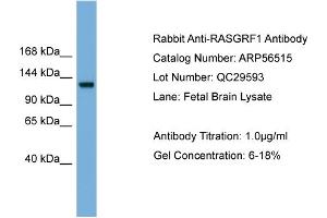 WB Suggested Anti-RASGRF1  Antibody Titration: 0. (RASGRF1 抗体  (Middle Region))