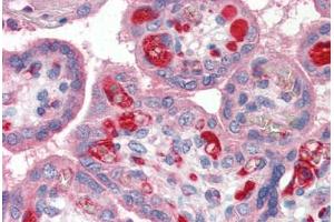 Human Placenta (formalin-fixed, paraffin-embedded) stained with PLTP antibody ABIN337143 at 1:100 followed by biotinylated goat anti-rabbit IgG secondary antibody ABIN481713, alkaline phosphatase-streptavidin and chromogen. (PLTP 抗体)