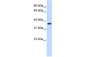 WB Suggested Anti-ZNF444 Antibody Titration:  0. (ZNF444 抗体  (Middle Region))