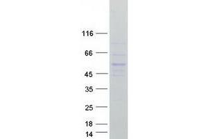 Validation with Western Blot