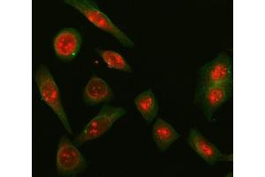 IF analysis of SNRPD2 and Tubulin beta using anti-SNRPD2 antibody (ABIN7598963) and anti-Tubulin beta antibody (ABIN7602744).
