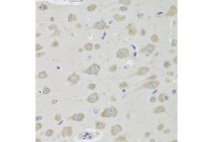 Immunohistochemistry of paraffin-embedded rat brain using DHRS9 Antibody (ABIN1980340) at dilution of 1:100 (40x lens). (DHRS9 抗体)
